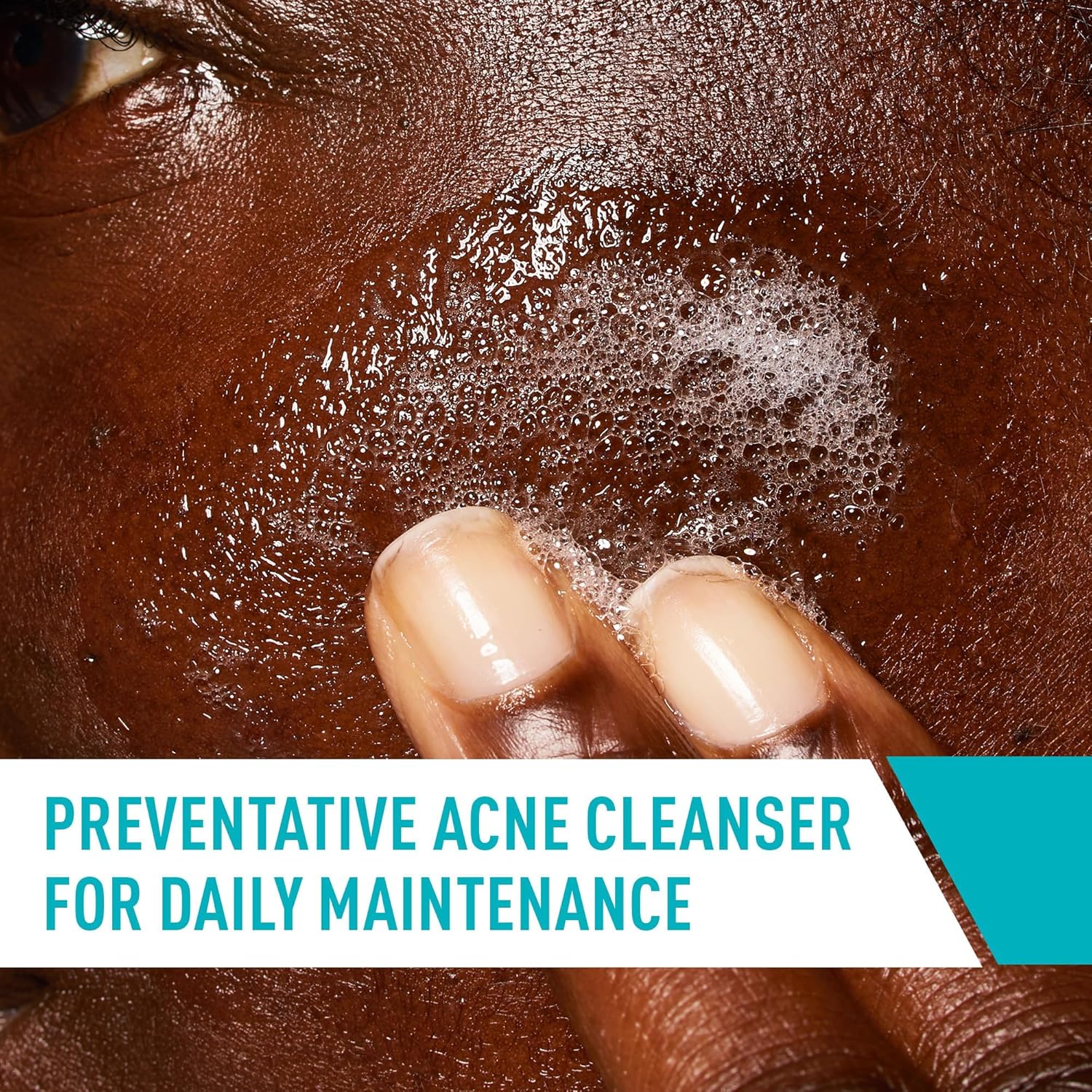 Cerave Acne Control Cleanser-237ml thumbnail 6