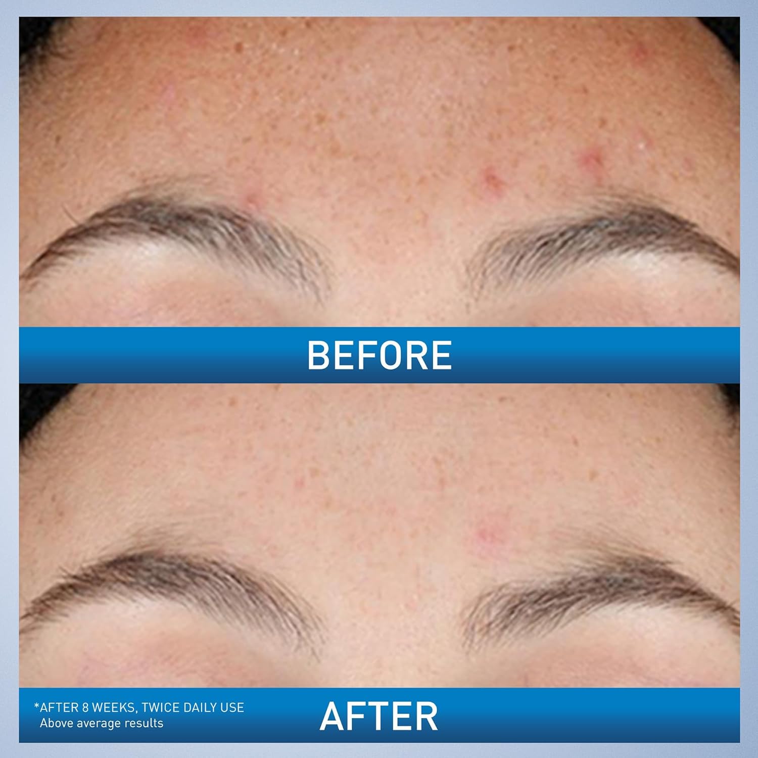 Cerave Resurfacing Retinol Serum-30ml thumbnail 7