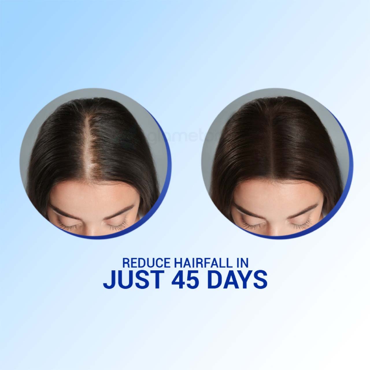 Parachute Advansed Extra Care Anti Hairfall Oil-75ml Root Applier thumbnail 6