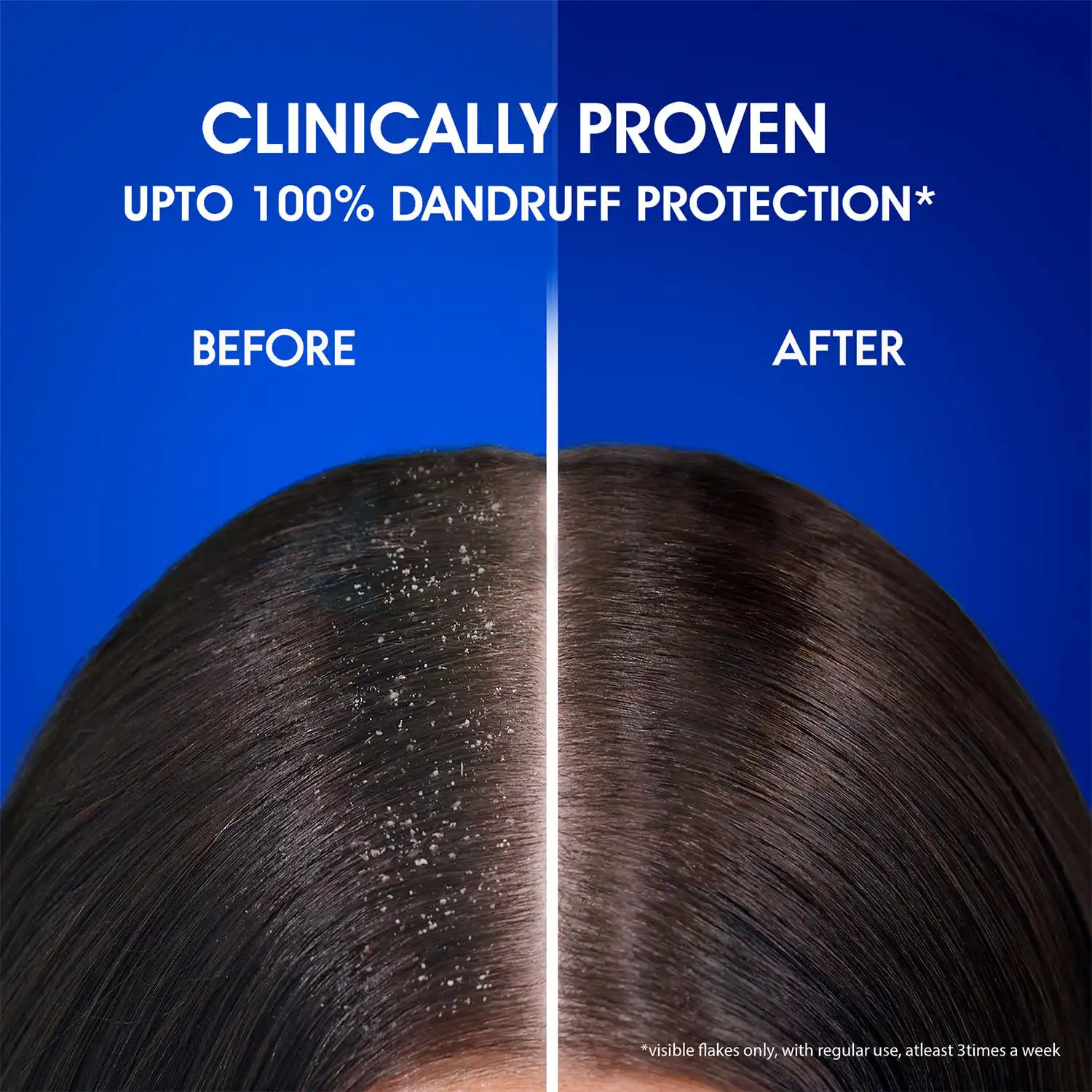 Head & Shoulders Anti Dandruff Shampoo Smooth & Silky-1L