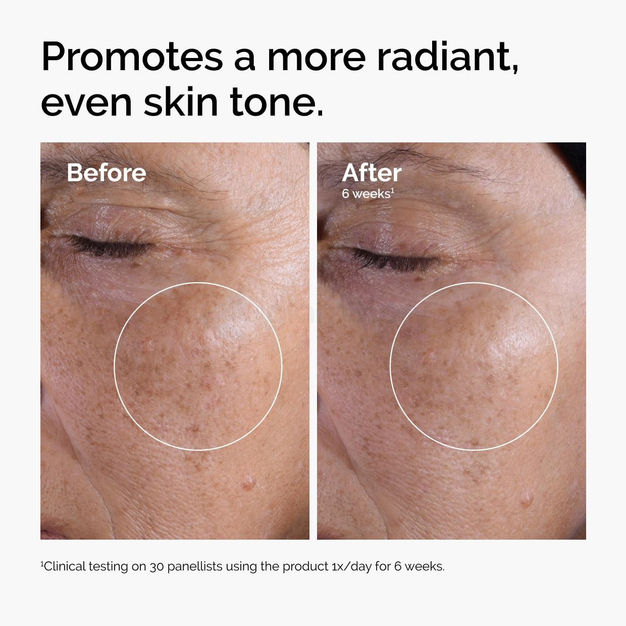 The Ordinary Glycolic Acid 7% Exfoliating Toner-240ml thumbnail 5